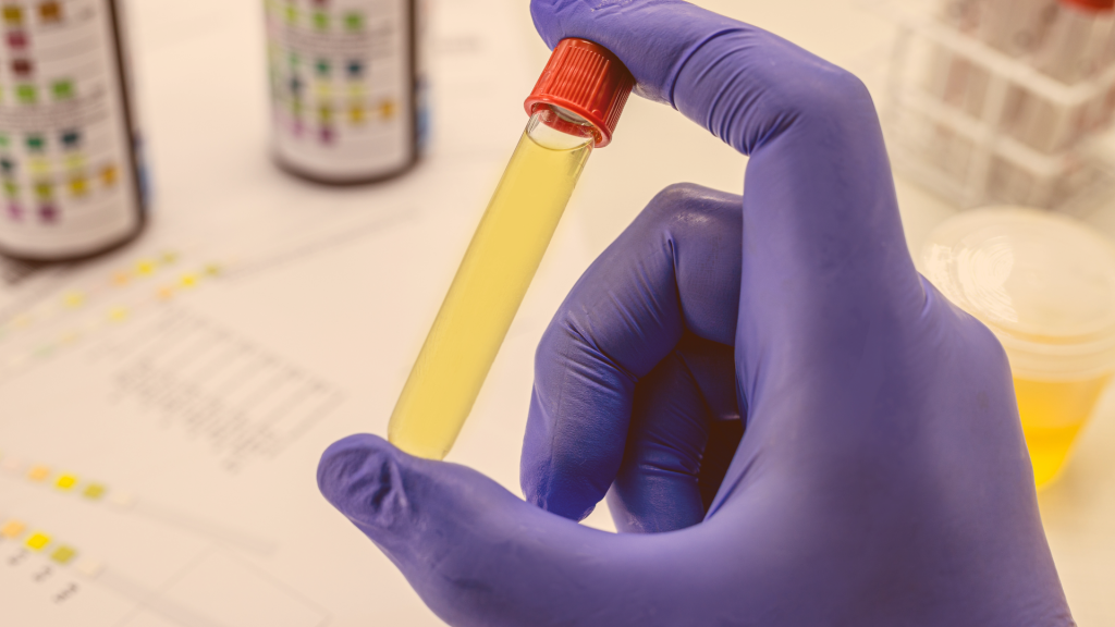 Vinagre no exame toxicológico urina